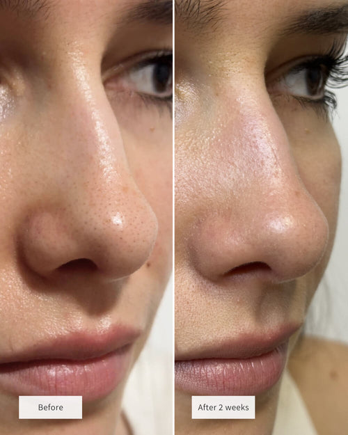 Clear Pore Duo Complete Kit